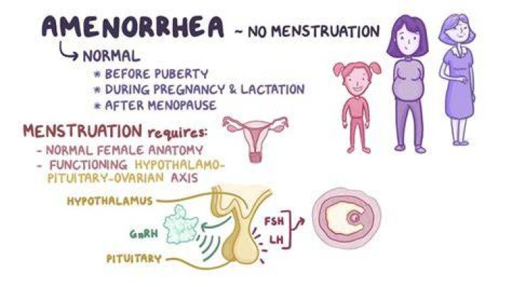 Can primary amenorrhea be cured?