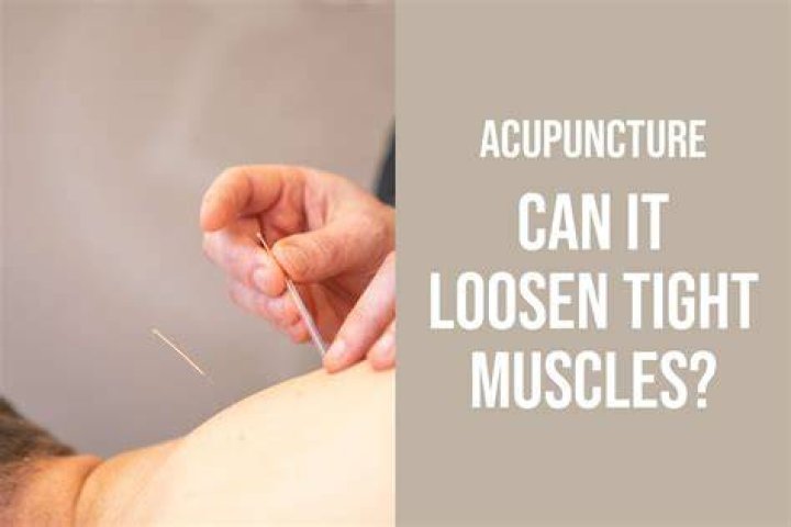 Does acupuncture help with diaphoresis?