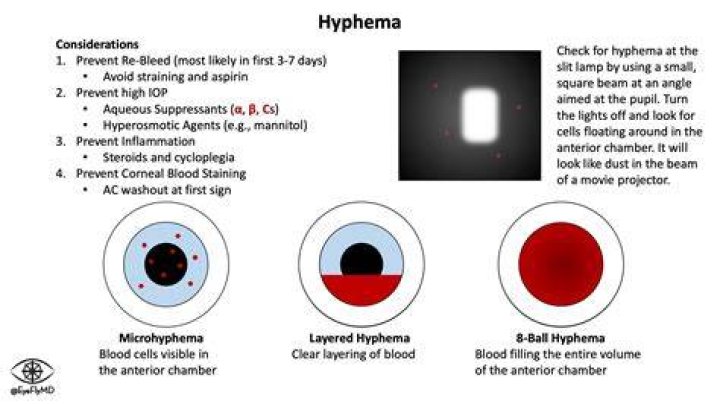 Does hyphema cause blindness?