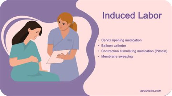 Should i get induced?