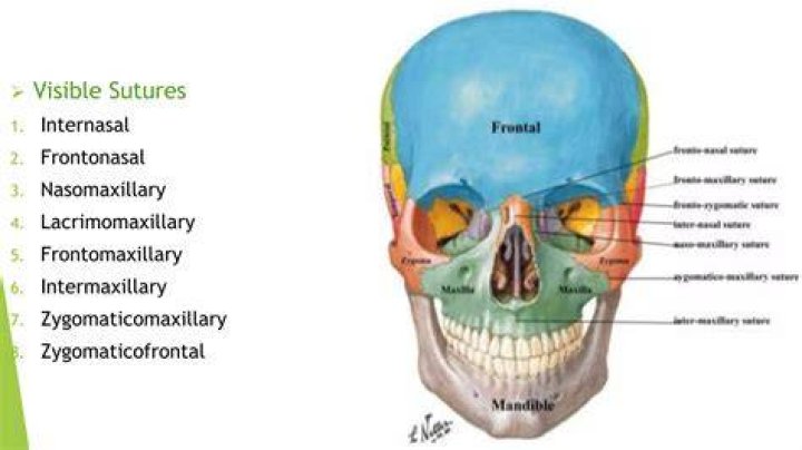 What are internasal suture?