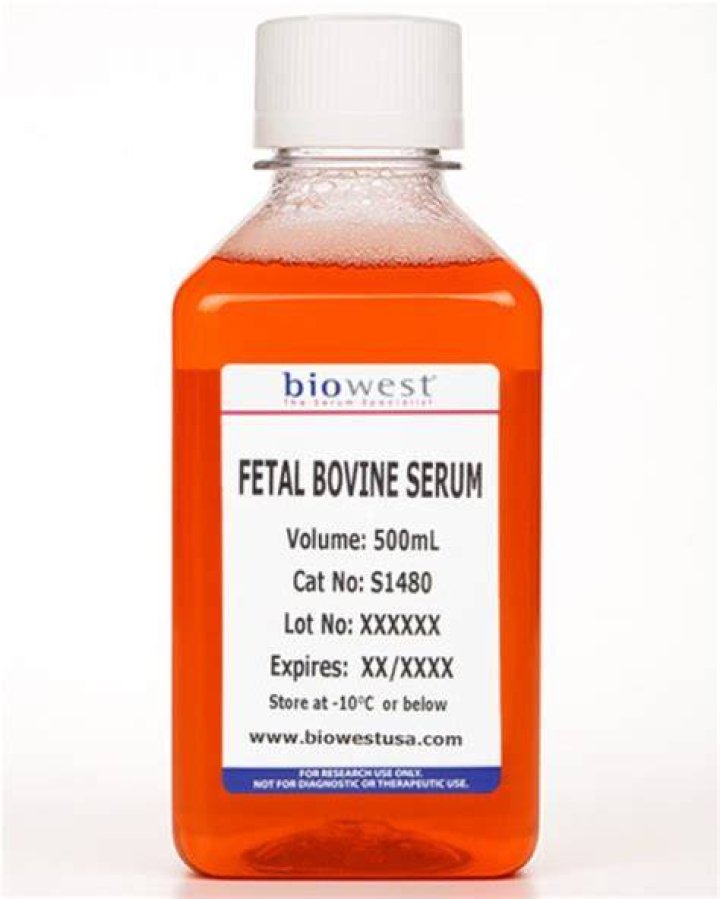 Whats fetal bovine serum?