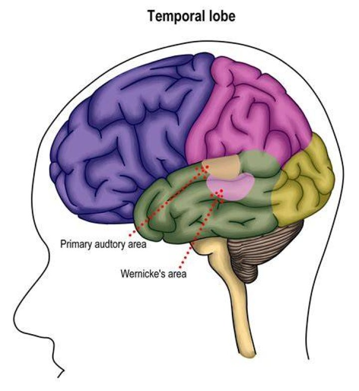 Where is wernicke's area found?
