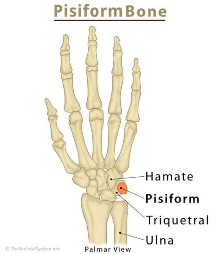 Why is my pisiform bone sore?